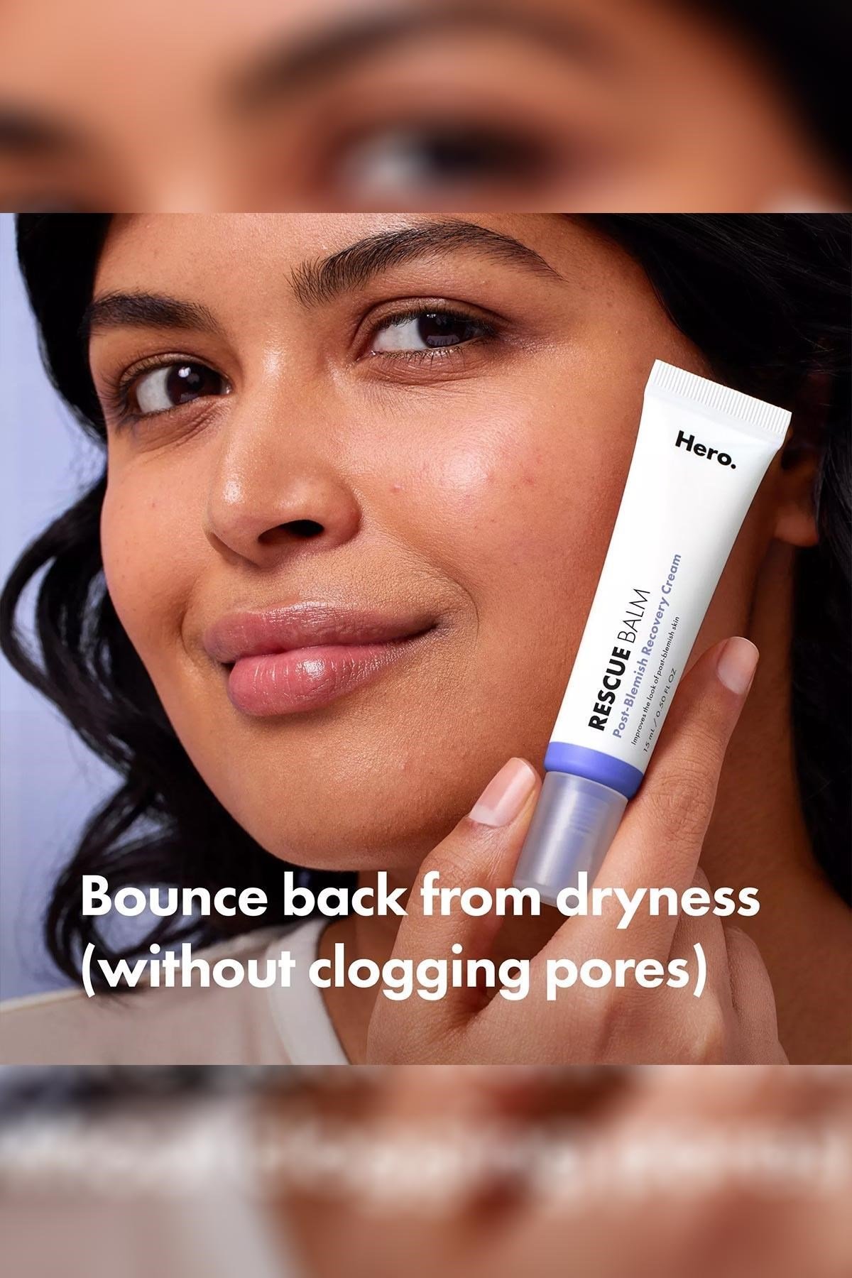 Hero Cosmetics Rescue Balm Akne Sonrası Leke Karşıtı Yüz Kremi 15ML