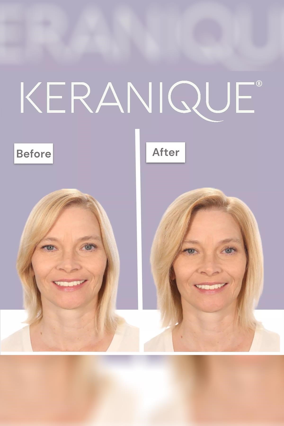 Keranique Volumizing Follicle Strengthening Şampuan 355ML