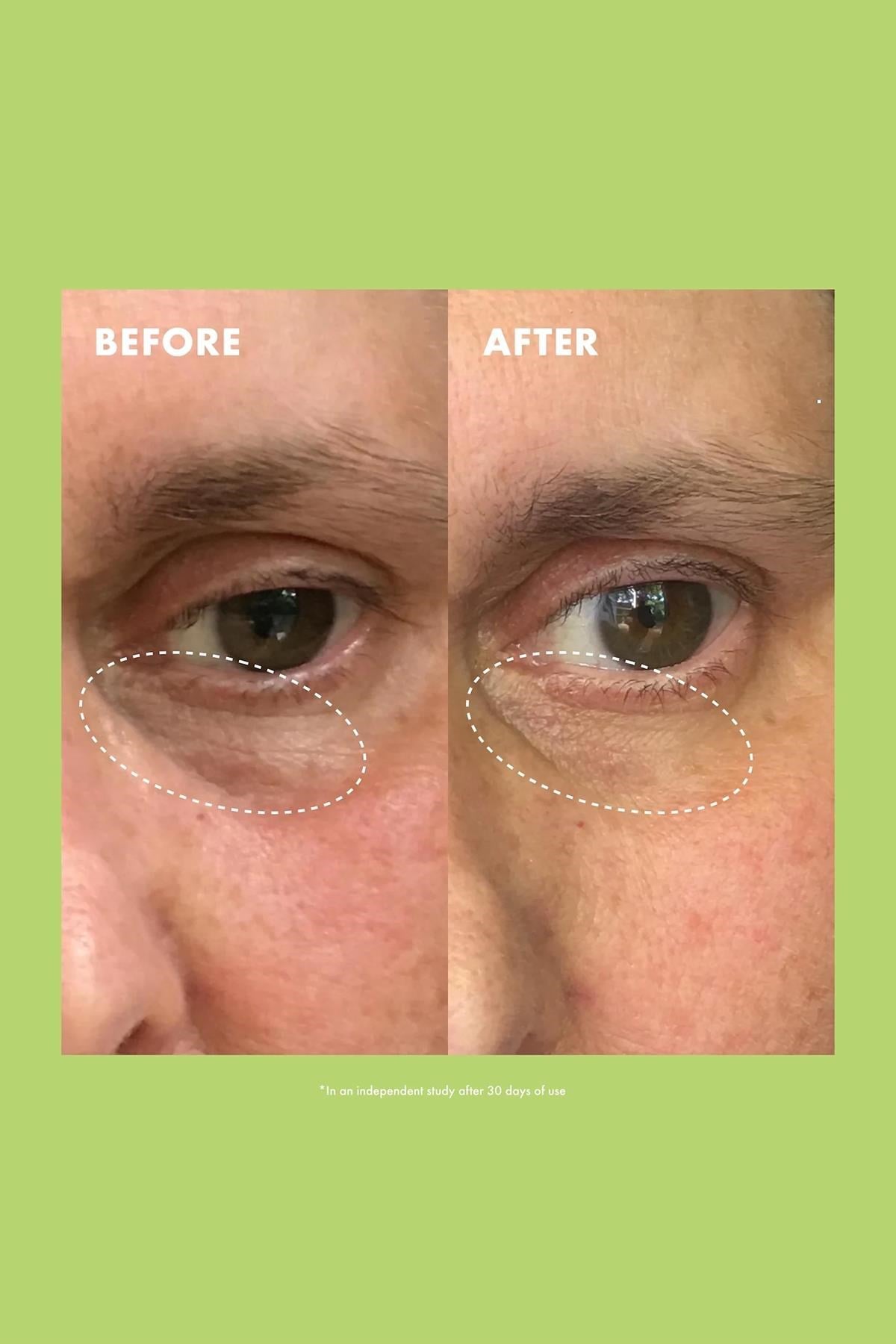 Kopari Niacinamide & Caffeine Aydınlatıcı Göz Kremi 15GR