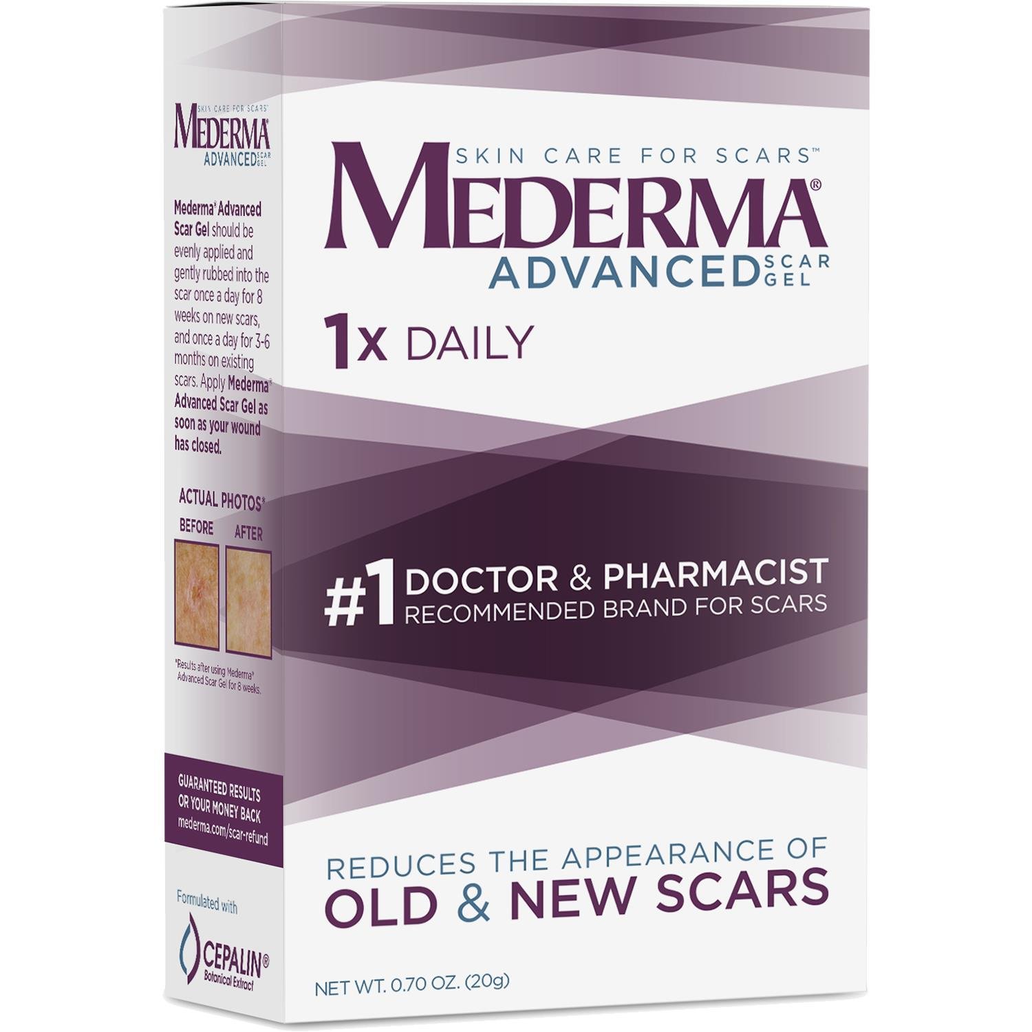 Mederma Advanced Scar Gel 20GR