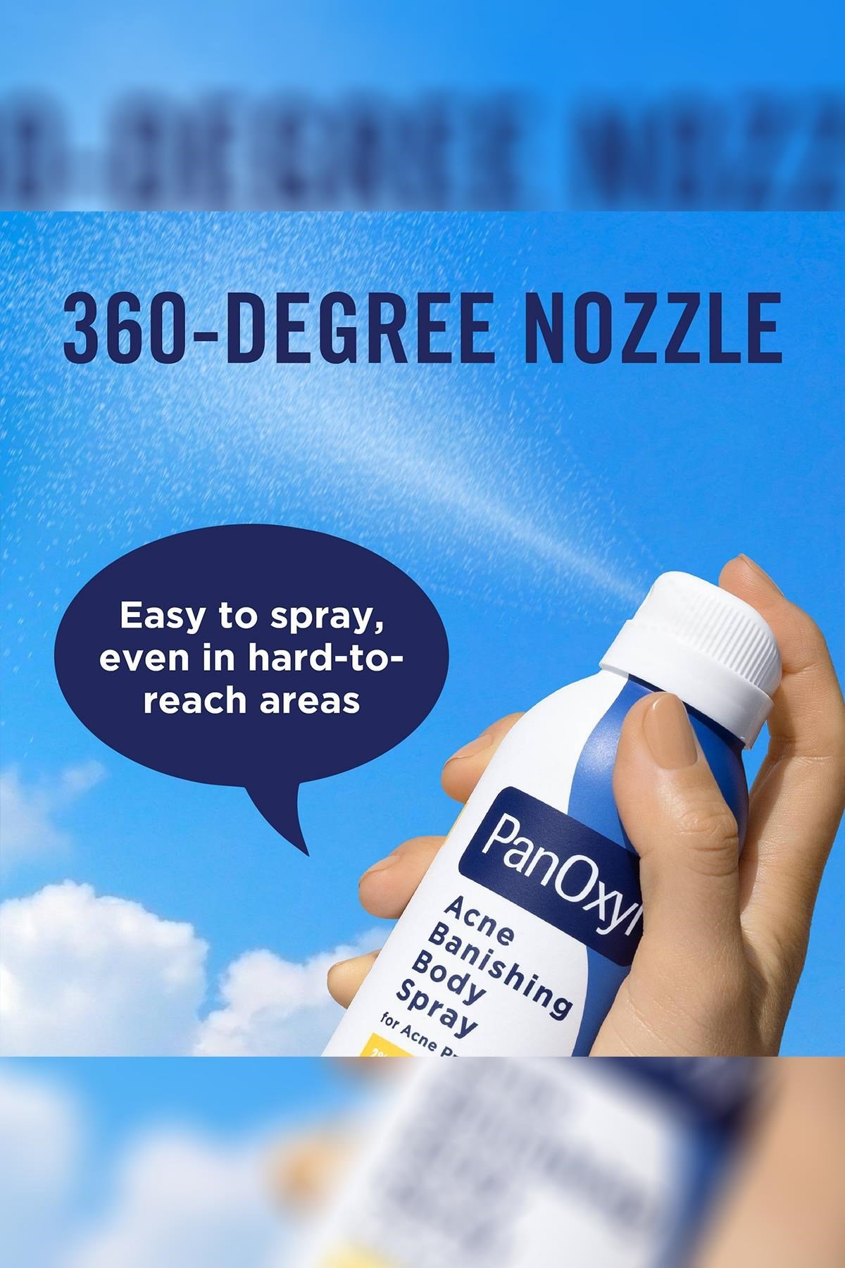 PanOxyl Akne Karşıtı Vücut Spreyi 170GR