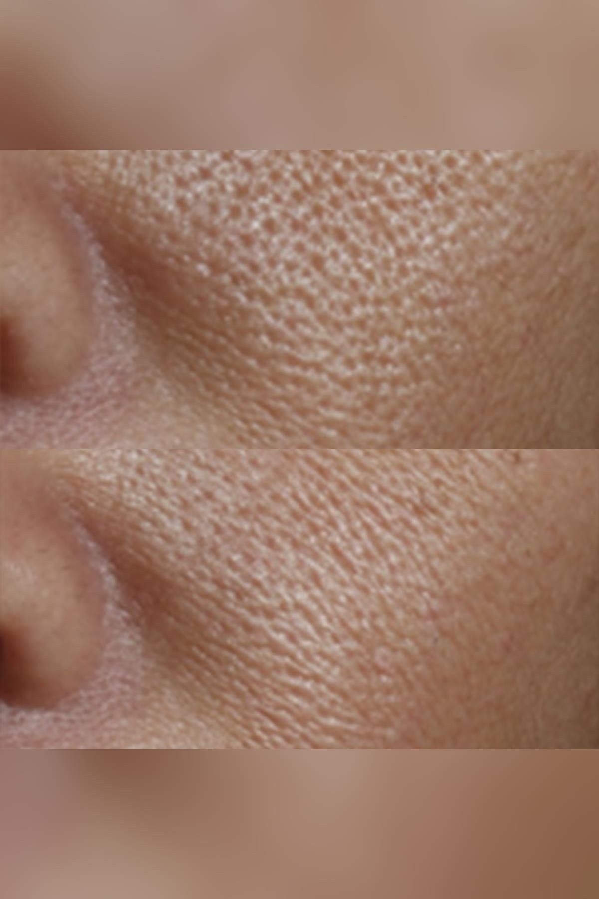 Perricone MD Gözenek Sıkılaştırıcı Yüz Toniği 118ML