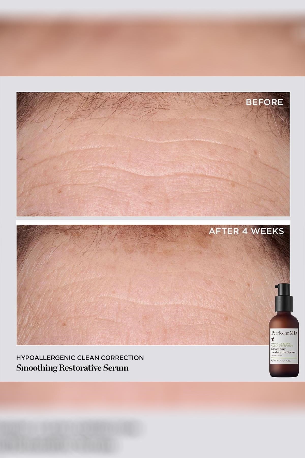 Perricone MD Hypoallergenic Clean Correction Smoothing Restorative Yüz Serumu 59ML