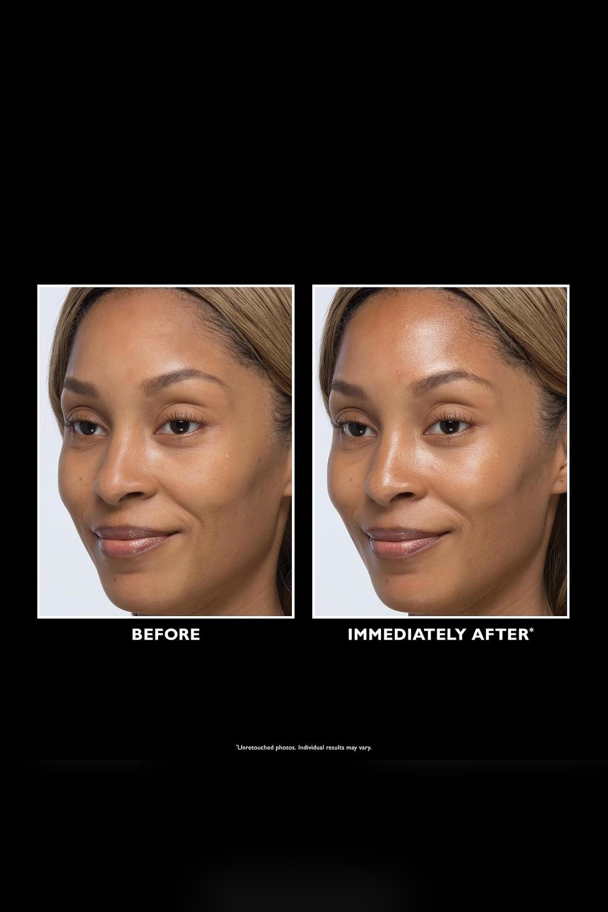 Peter Thomas Roth Instant FIRMx Glow Filter Aydınlatıcı Yüz Serumu 30ML