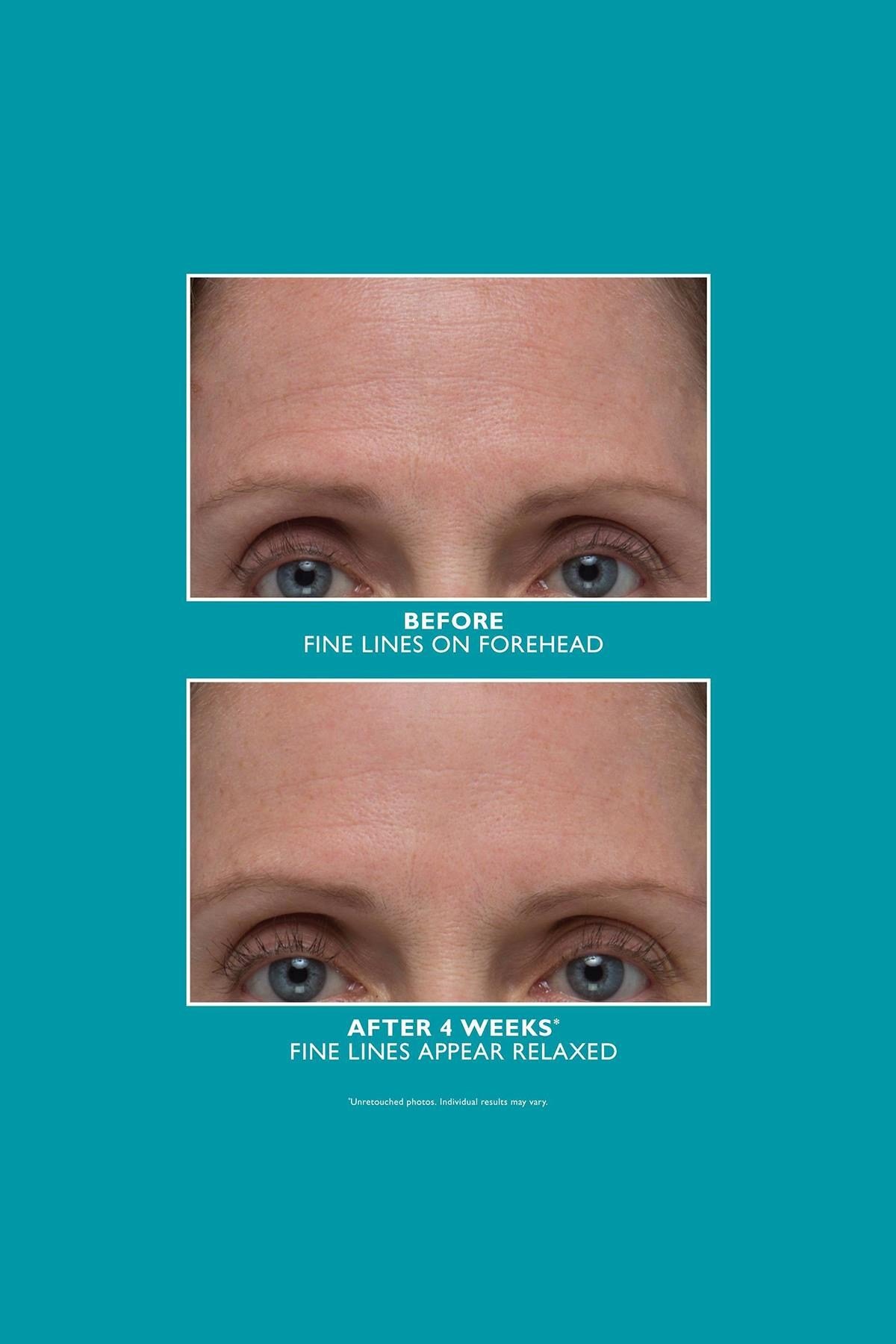 Peter Thomas Roth Peptide Skinjection Amplified Wrinkle-Fix Yüz Serumu 30ML