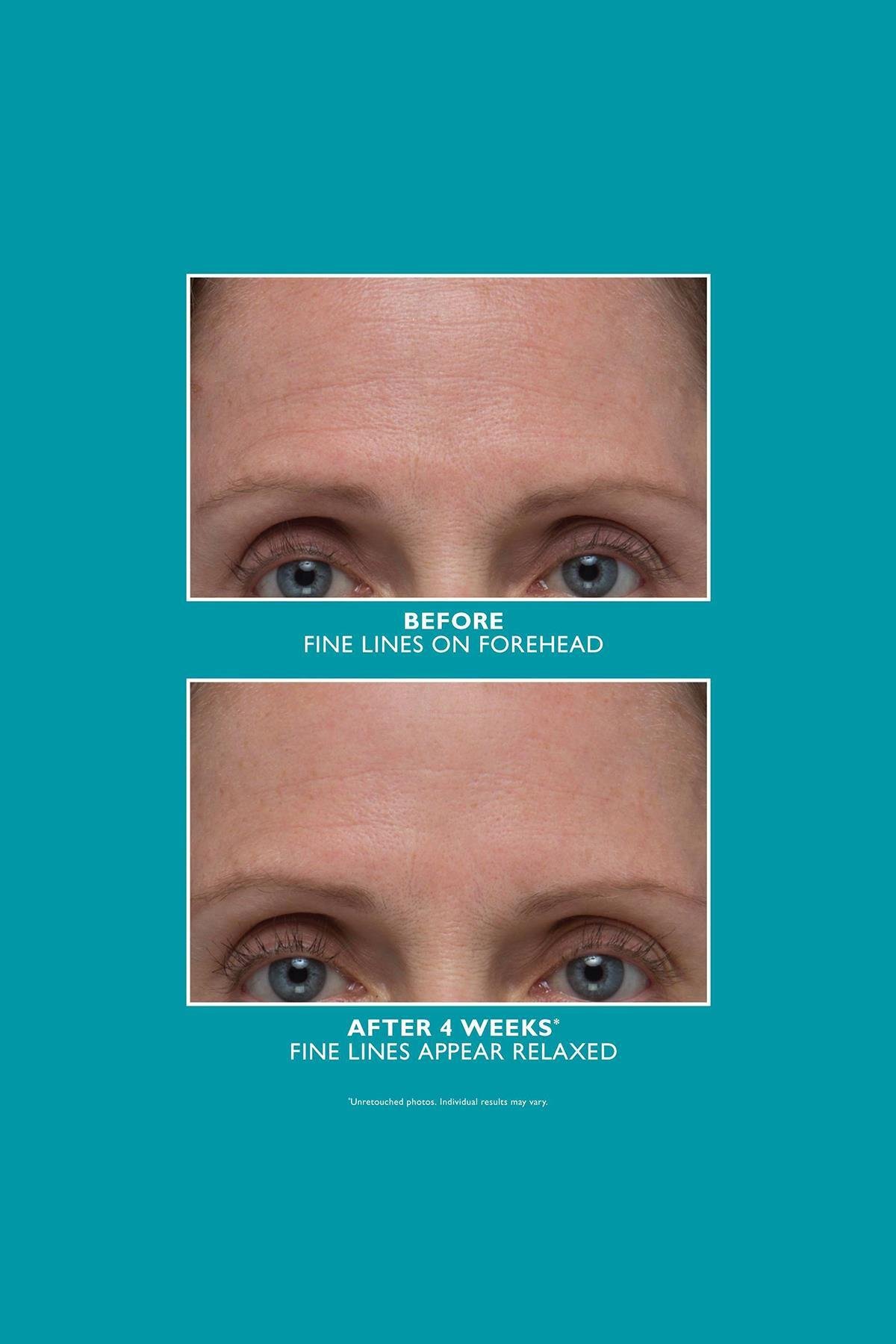 Peter Thomas Roth Peptide Skinjection Amplified Wrinkle-Fix Yüz Serumu 30ML