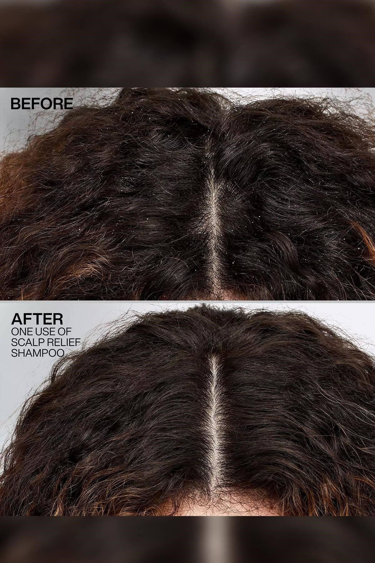 Redken Scalp Relief Kepek Karşıtı Şampuan 250ML