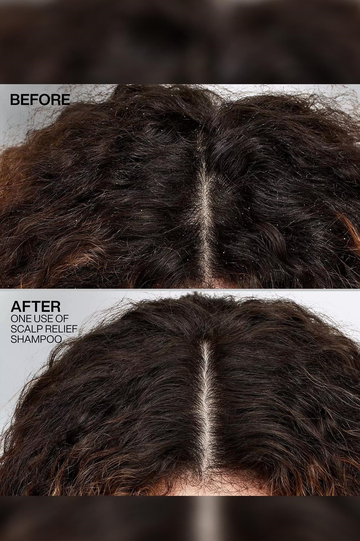 Redken Scalp Relief Kepek Karşıtı Şampuan 250ML