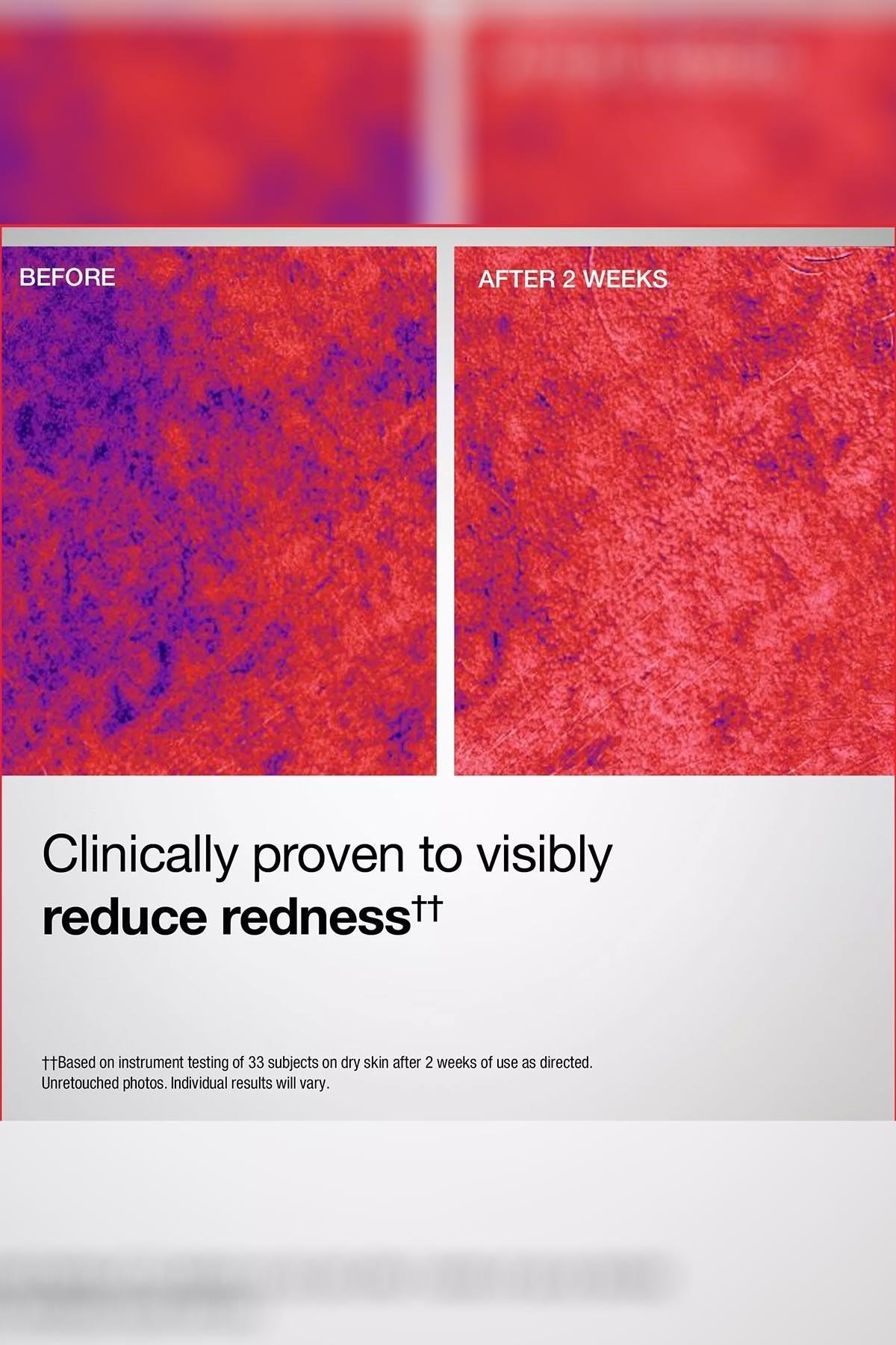 StriVectin Barrier Restore Yatıştırıcı Nemlendirici Yüz Spreyi 50ML