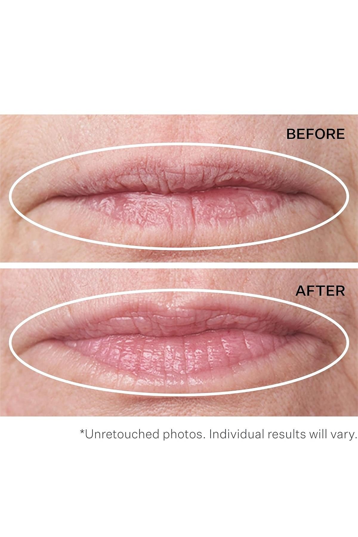 StriVectin Double Fix Dolgunlaştırıcı ve Dudak Çevresi Dikey Çizgi Bakımı 5ML