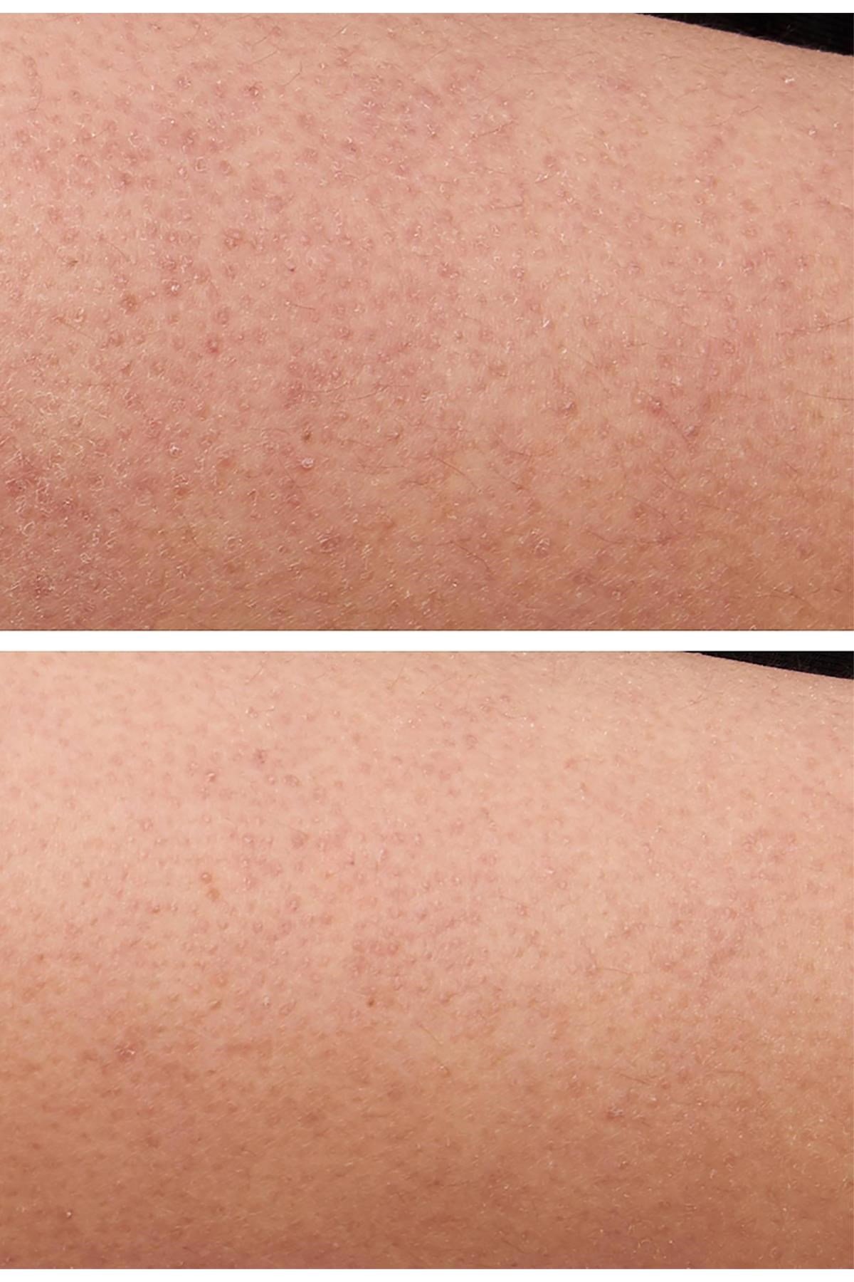 StriVectin KP Care Texture Smoothing Vücut Kremi 200ML
