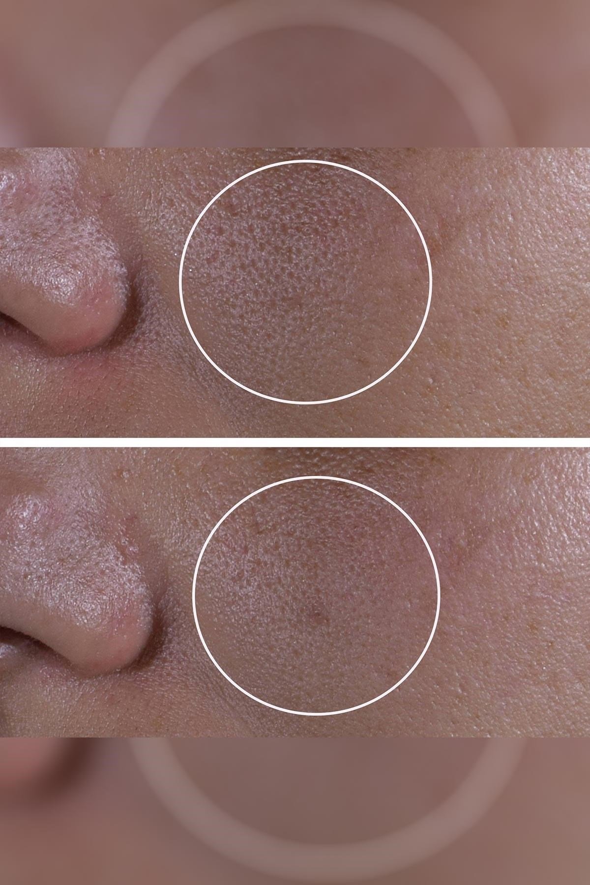 StriVectin Super Shrink Gözenek Sıkılaştırıcı Yüz Serumu 30ML