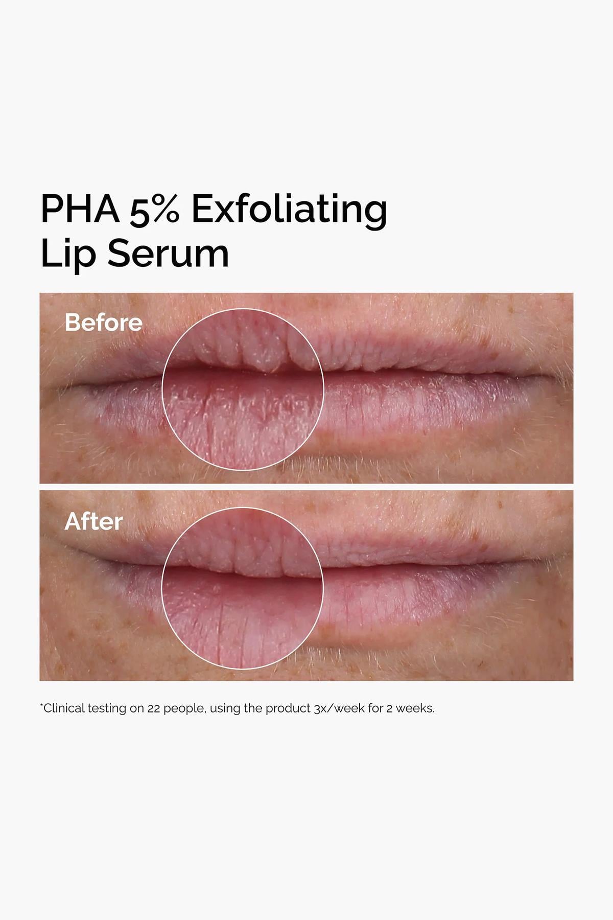 The Ordinary PHA %5 Peeling Etkili Dudak Serumu 15ML