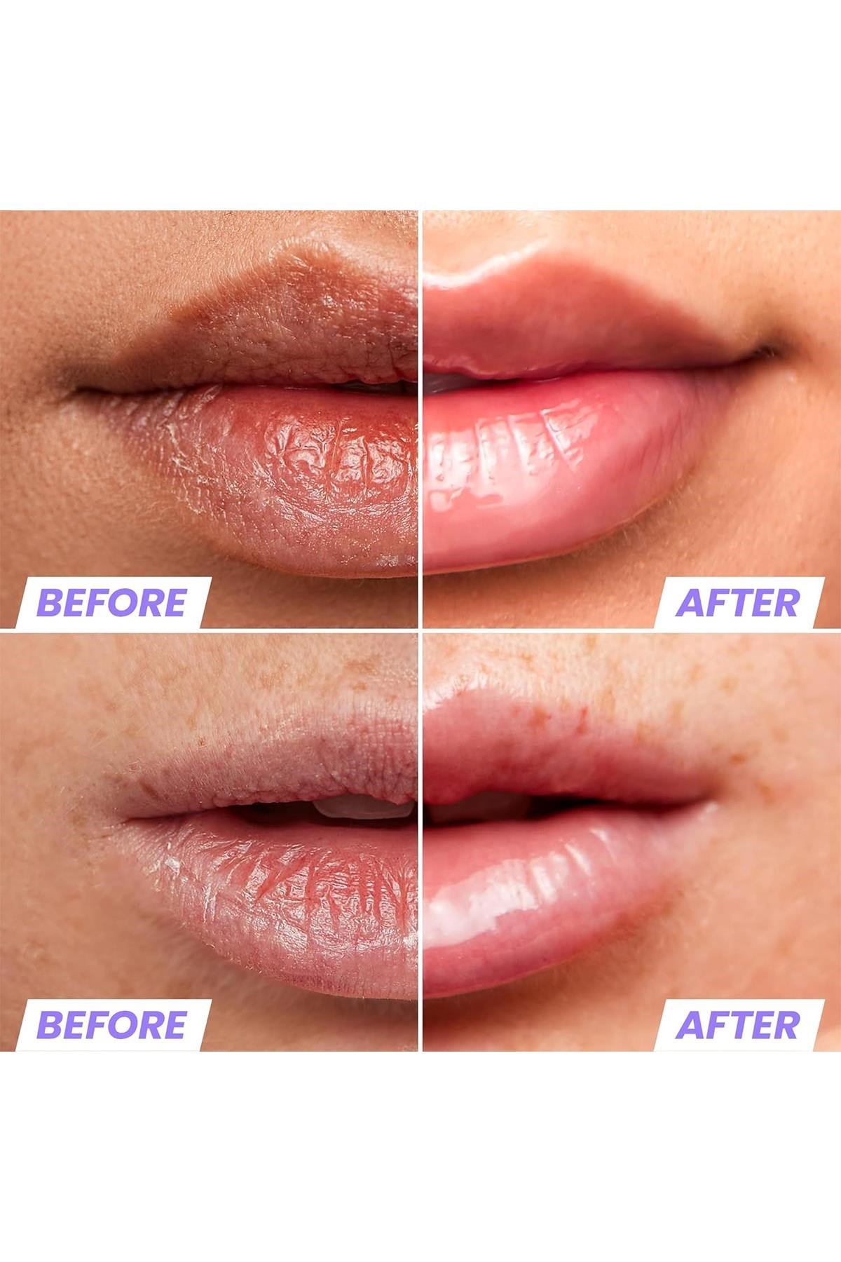 Wonderskin Lip Rehab Nemlendirici ve Onarıcı Şeffaf Dudak Serumu Yağı Clear 3.57ML