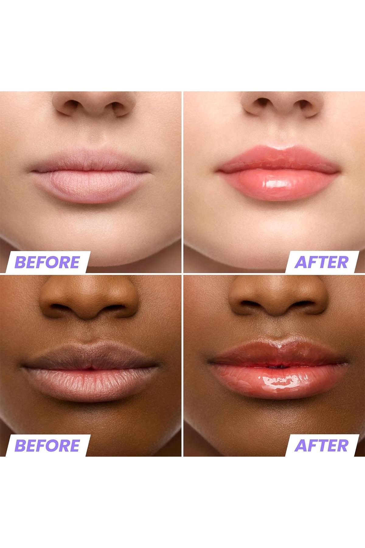 Wonderskin Lip Rehab Nemlendirici ve Onarıcı Renkli Dudak Serumu Yağı Flirt 3.57ML