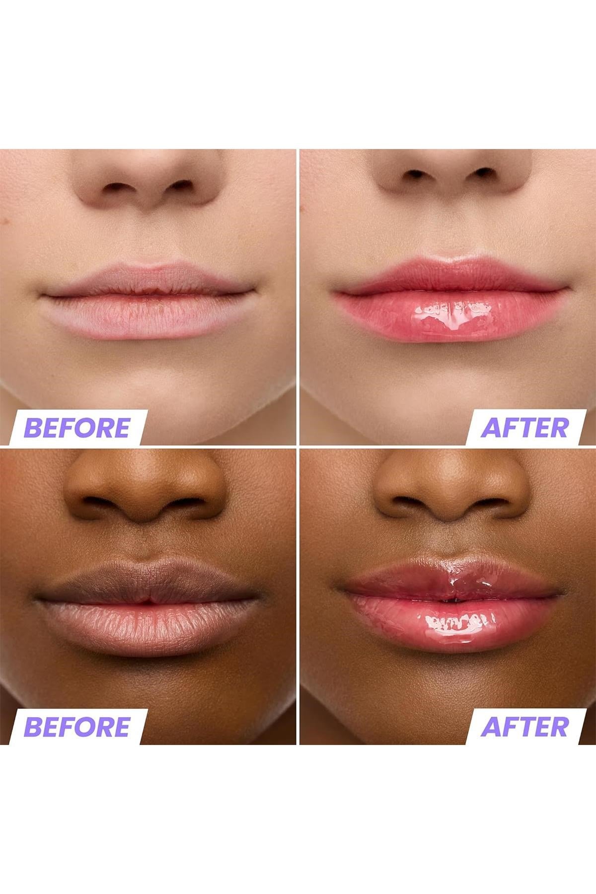 Wonderskin Lip Rehab Nemlendirici ve Onarıcı Renkli Dudak Serumu Yağı Amour 3.57ML