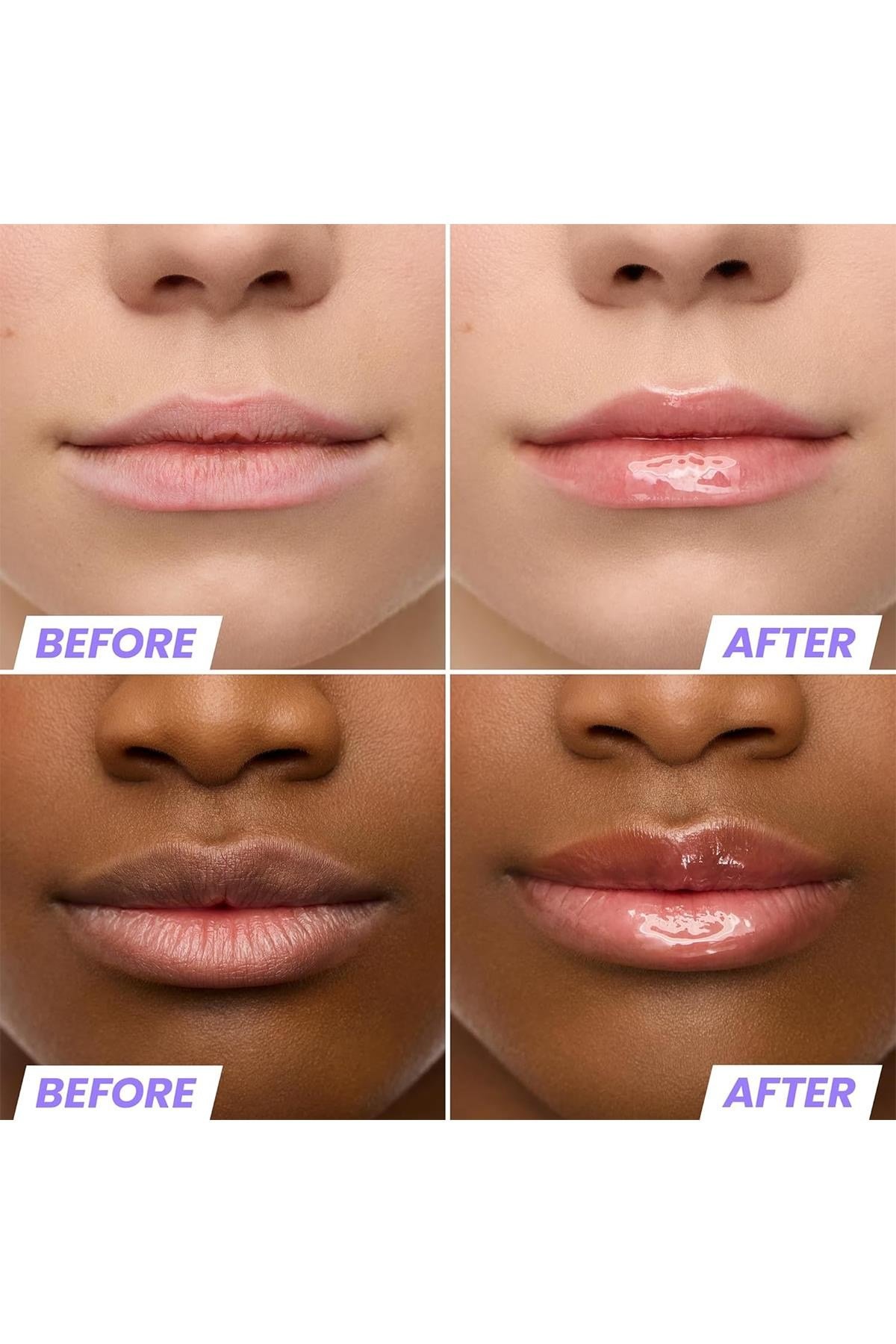 Wonderskin Lip Rehab Nemlendirici ve Onarıcı Renkli Dudak Serumu Yağı Lover 3.57ML