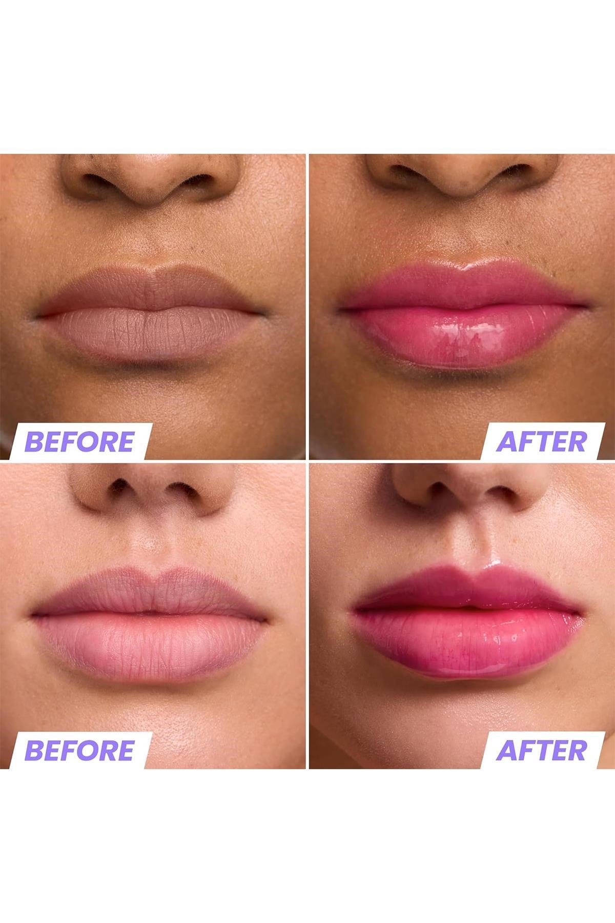 Wonderskin Lip Rehab Nemlendirici ve Onarıcı Renkli Dudak Serumu Yağı Kissed 3.57ML