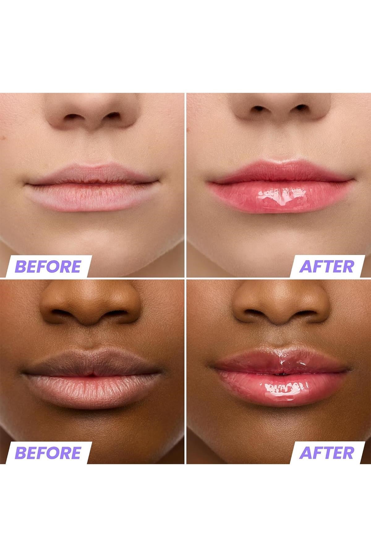Wonderskin Lip Rehab Nemlendirici ve Onarıcı Renkli Dudak Serumu Yağı Amour 3.57ML