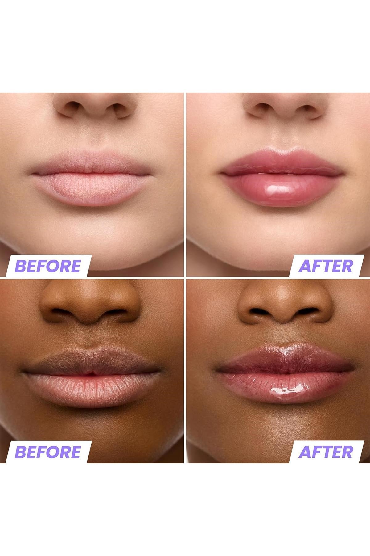 Wonderskin Lip Rehab Nemlendirici ve Onarıcı Renkli Dudak Serumu Yağı Honey 3.57ML