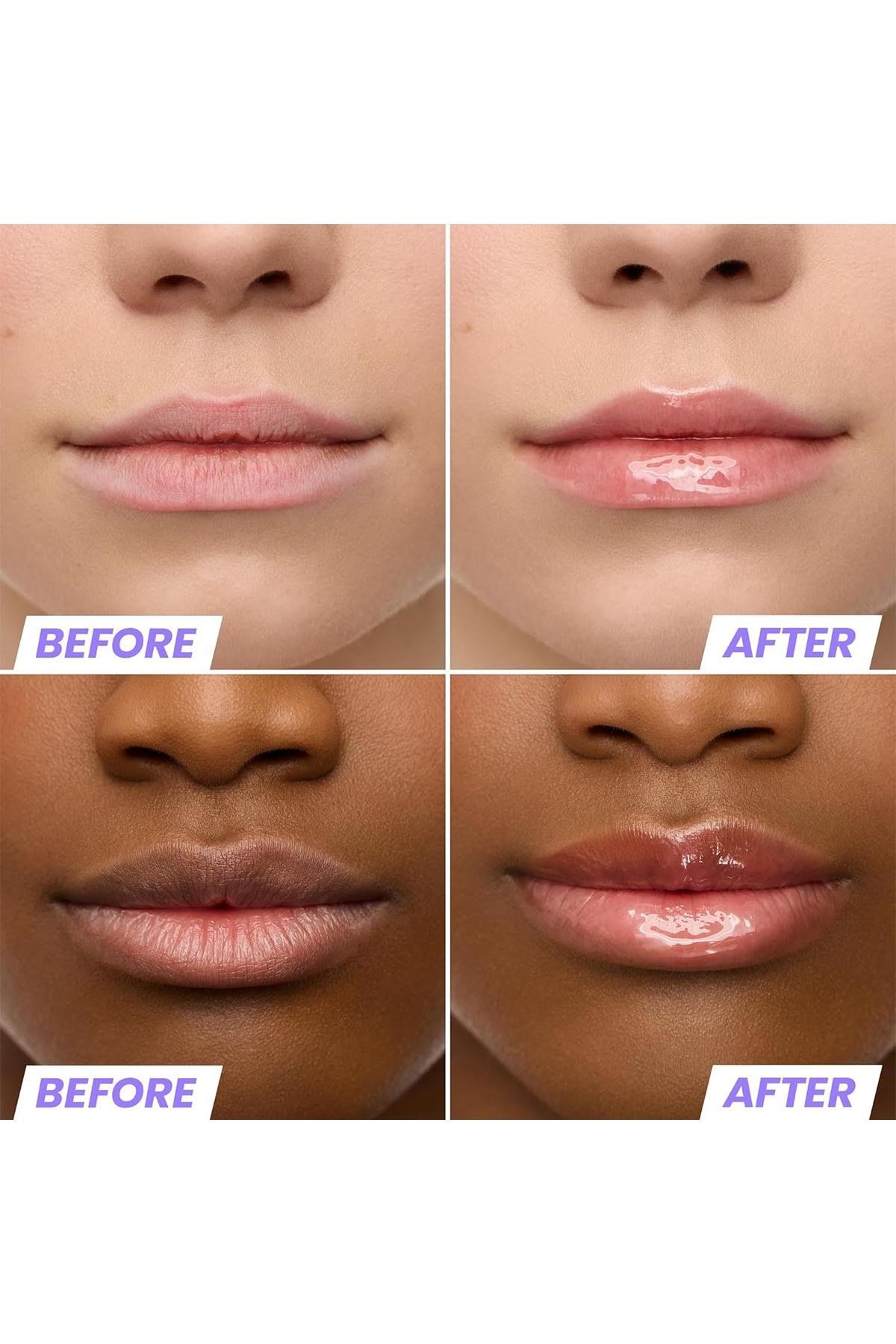 Wonderskin Lip Rehab Nemlendirici ve Onarıcı Renkli Dudak Serumu Yağı Lover 3.57ML