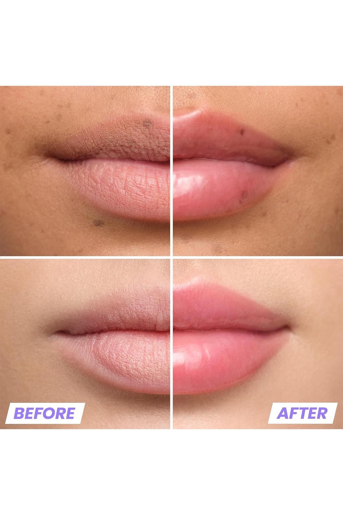 Wonderskin Lip Relapse Dolgunlaştırıcı Etki Şeffaf Dudak Parlatıcısı Clear 3.57ML