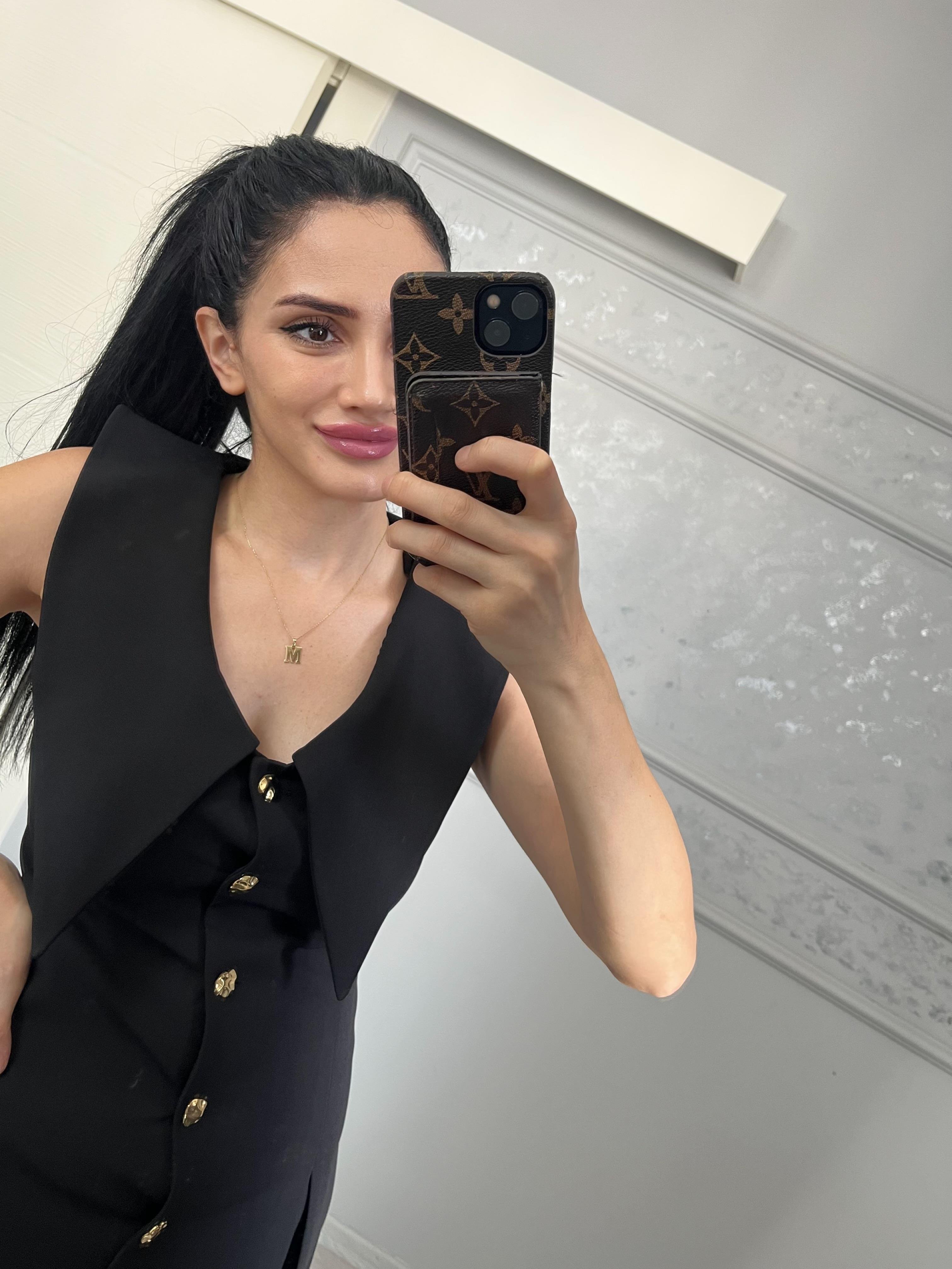Siyah Gold Düğmeli V Yaka Elbise