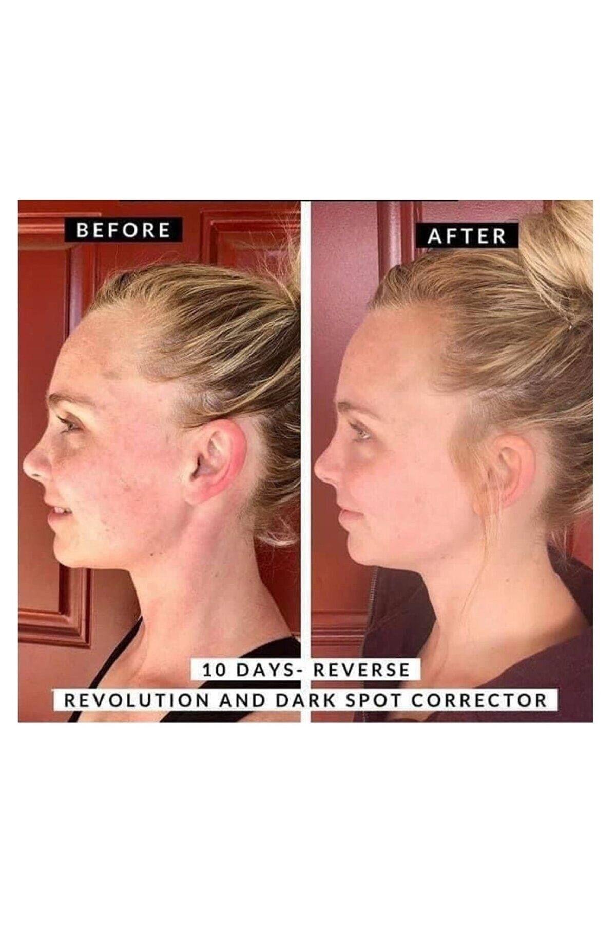 Dark Spot Corrector Vegan Cruelty Free Serum 30 Ml trend cosmatica