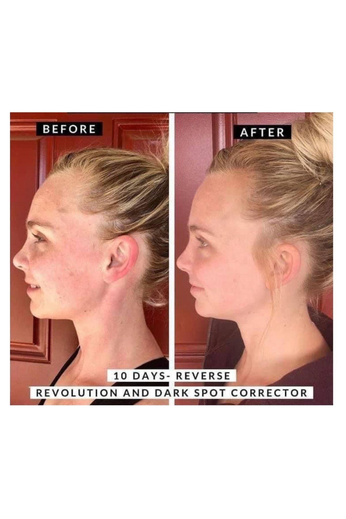 Skincare Dark Spot Corrector Kararmalara Karşı Etkili Vegan Cilt Serumu 30 Ml