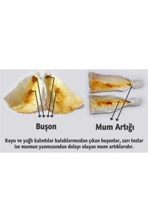 Trade Bazaar Doğal Kulak Temizleme Mumu 2 Adet