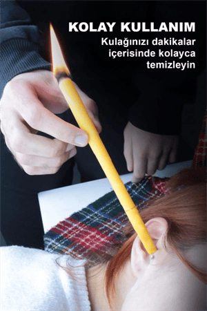Trade Bazaar Doğal Kulak Temizleme Mumu 2 Adet