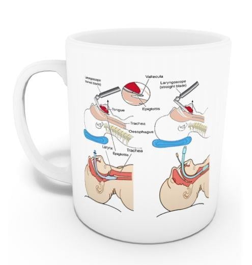 Anestezi Kupası (İsme Özel)