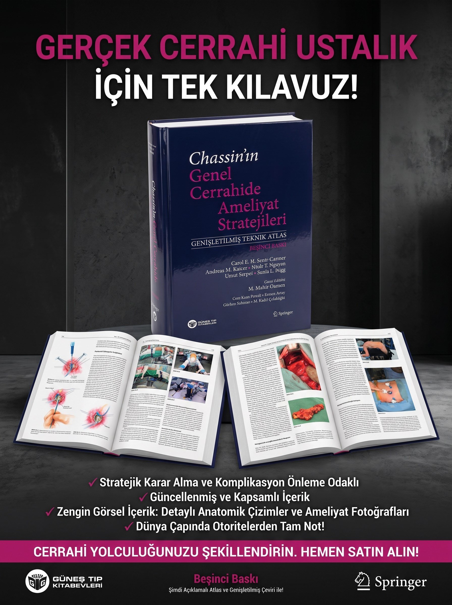 Chassin'ın  Genel Cerrahide Ameliyat Stratejileri (Genişletilmiş Teknik Atlas)