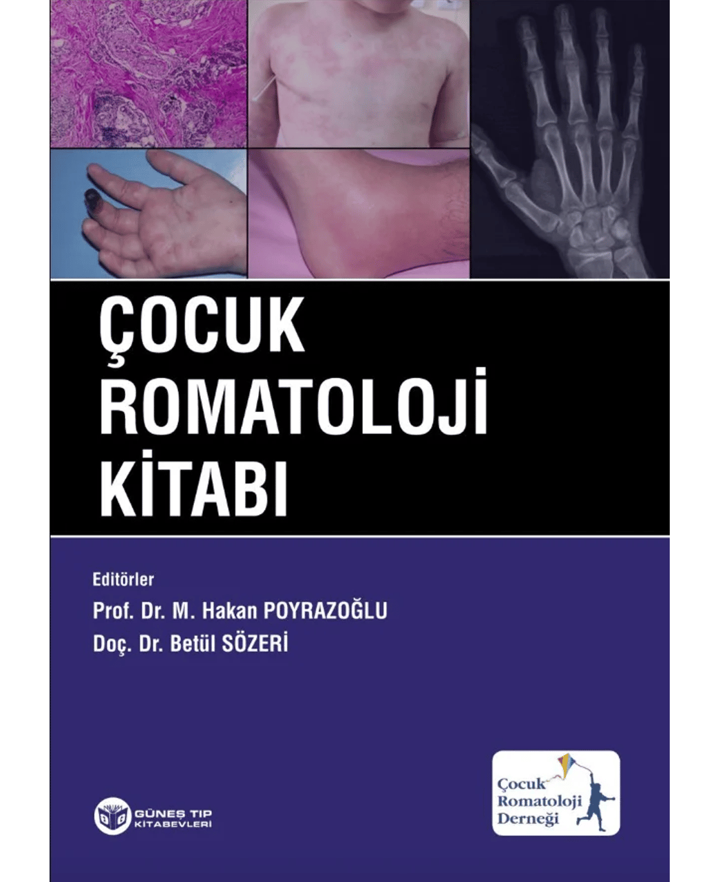 Çocuk Romatoloji Kitabı
