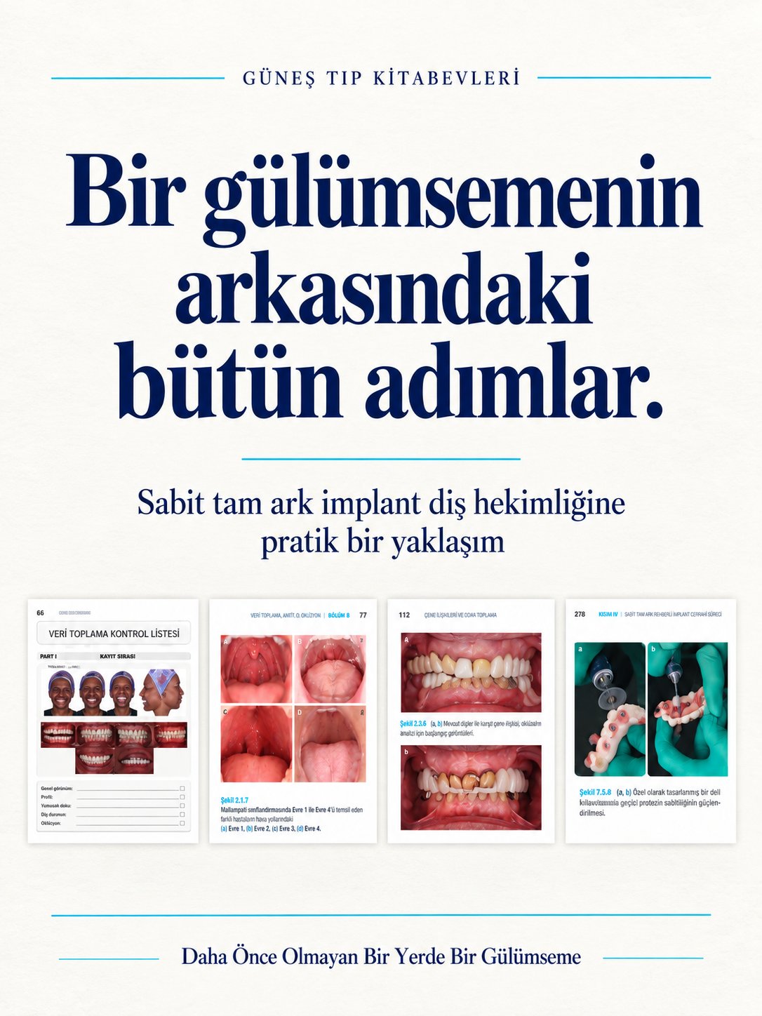 Daha Önce Olmayan Bir Yerde Bir Gülümseme: Sabit Tam Çember İmplant - Diş Hekimliğine Pratik Bir Yaklaşım