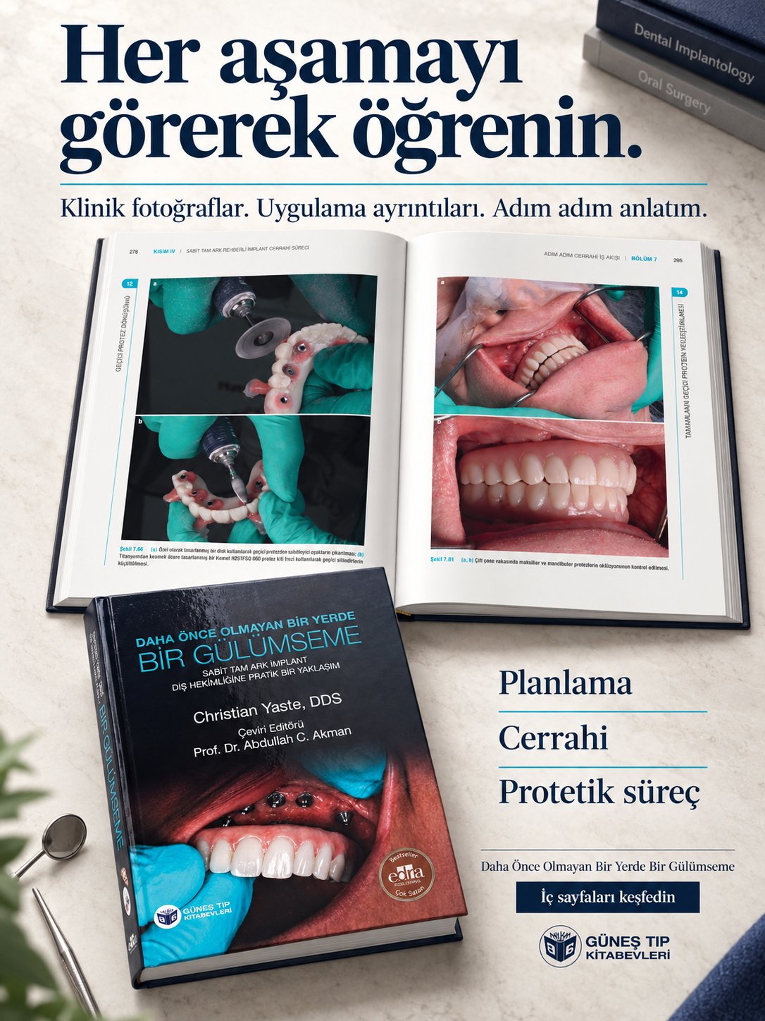 Daha Önce Olmayan Bir Yerde Bir Gülümseme: Sabit Tam Çember İmplant - Diş Hekimliğine Pratik Bir Yaklaşım