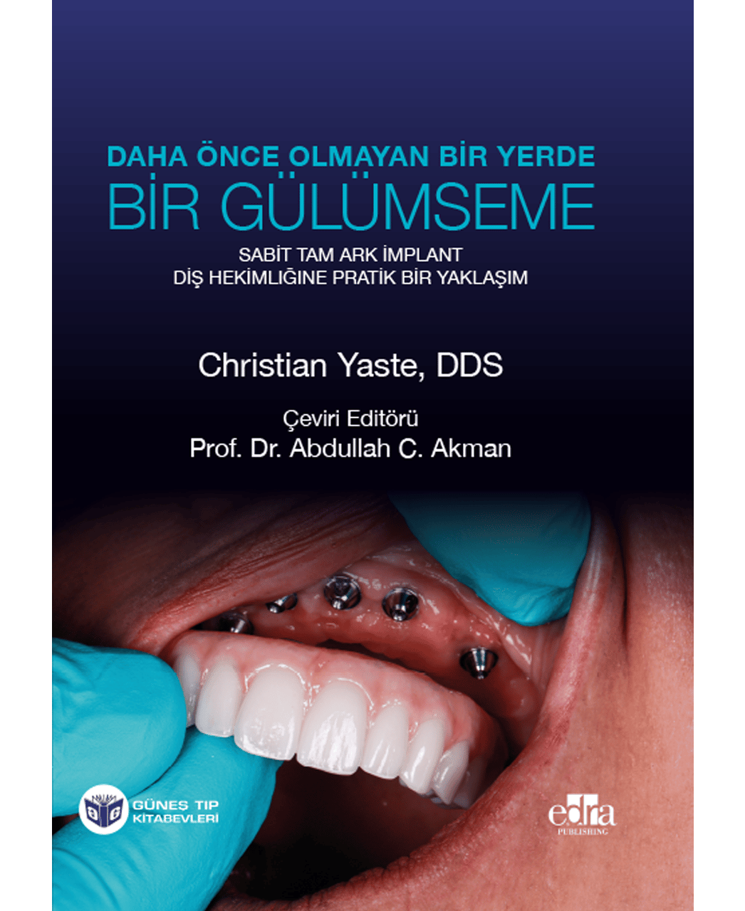 Daha Önce Olmayan Bir Yerde Bir Gülümseme: Sabit Tam Çember İmplant - Diş Hekimliğine Pratik Bir Yaklaşım