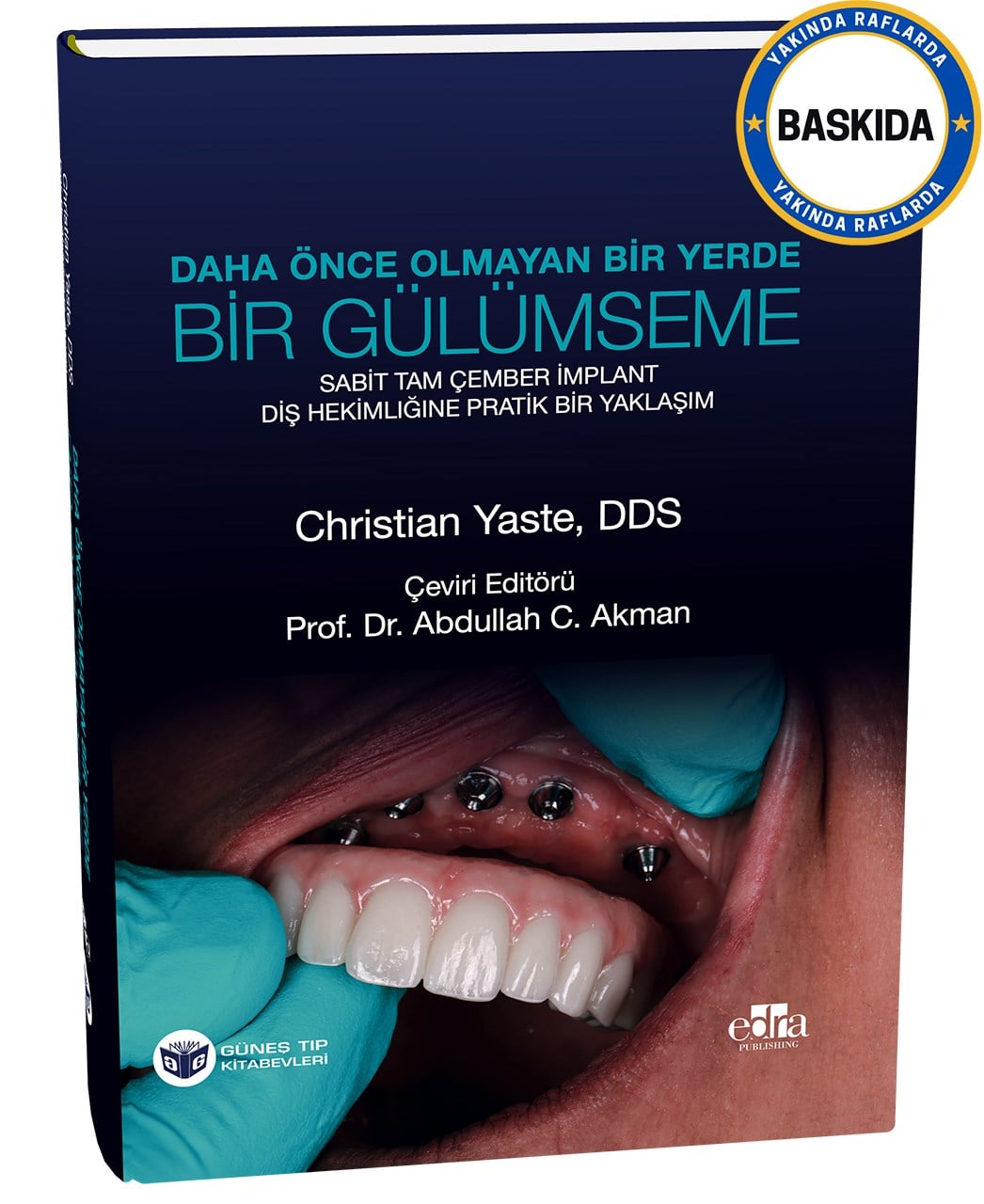 Daha Önce Olmayan Bir Yerde Bir Gülümseme: Sabit Tam Çember İmplant - Diş Hekimliğine Pratik Bir Yaklaşım