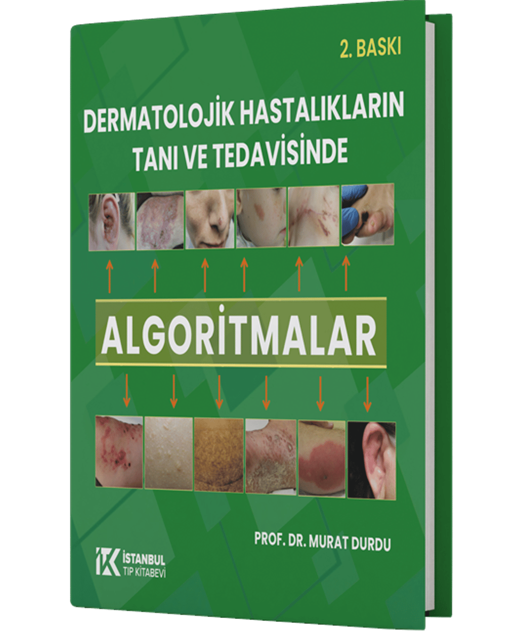 Dermatolojik Hastalıkların Tanı ve Tedavisinde Algoritmalar