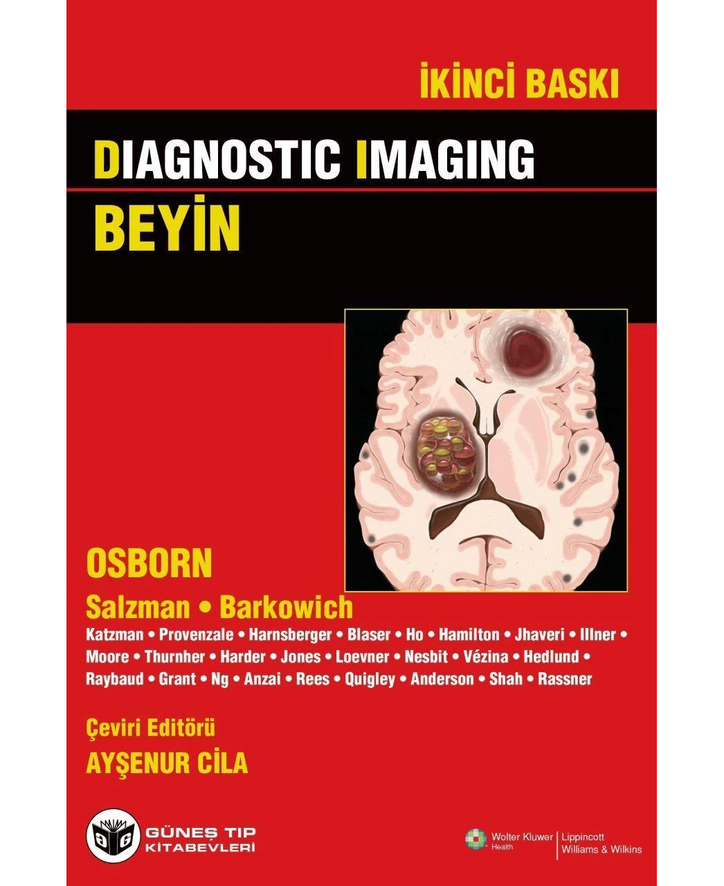 Diagnostic Imaging - Beyin