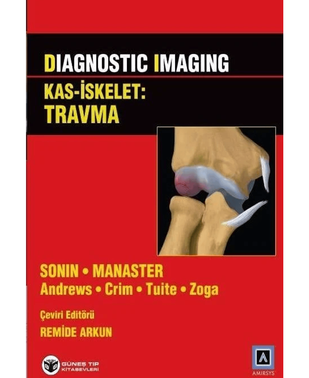 Diagnostic Imaging - Kas İskelet: Travma