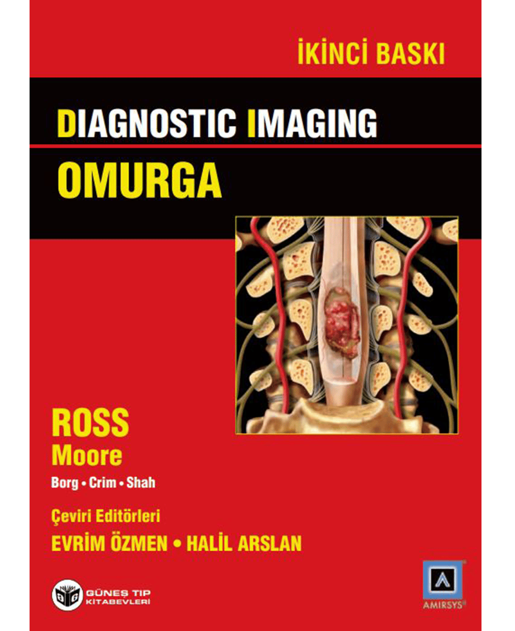 Diagnostic Imaging - Omurga