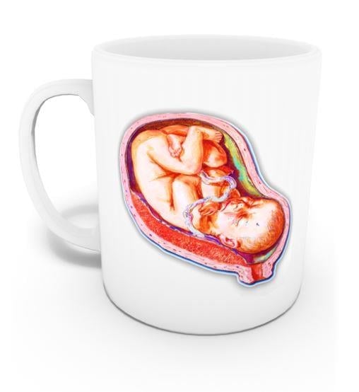 Ebe Kupası (İsme Özel)