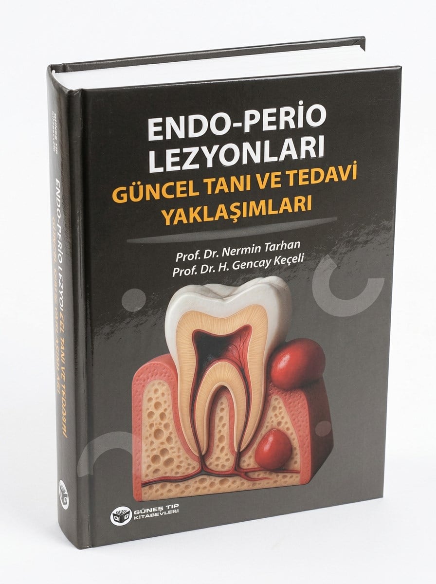 Endo - Perio Lezyonları Güncel Tanı ve Tedavi Yaklaşımları