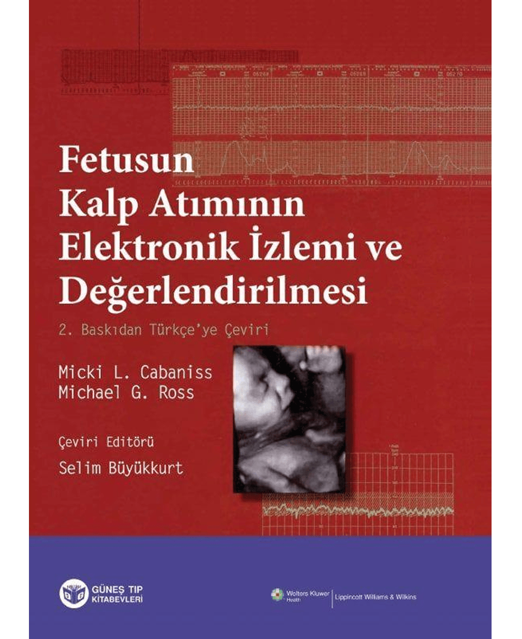 Fetusun Kalp Atımının Elektronik İzlemi ve Değerlendirilmesi
