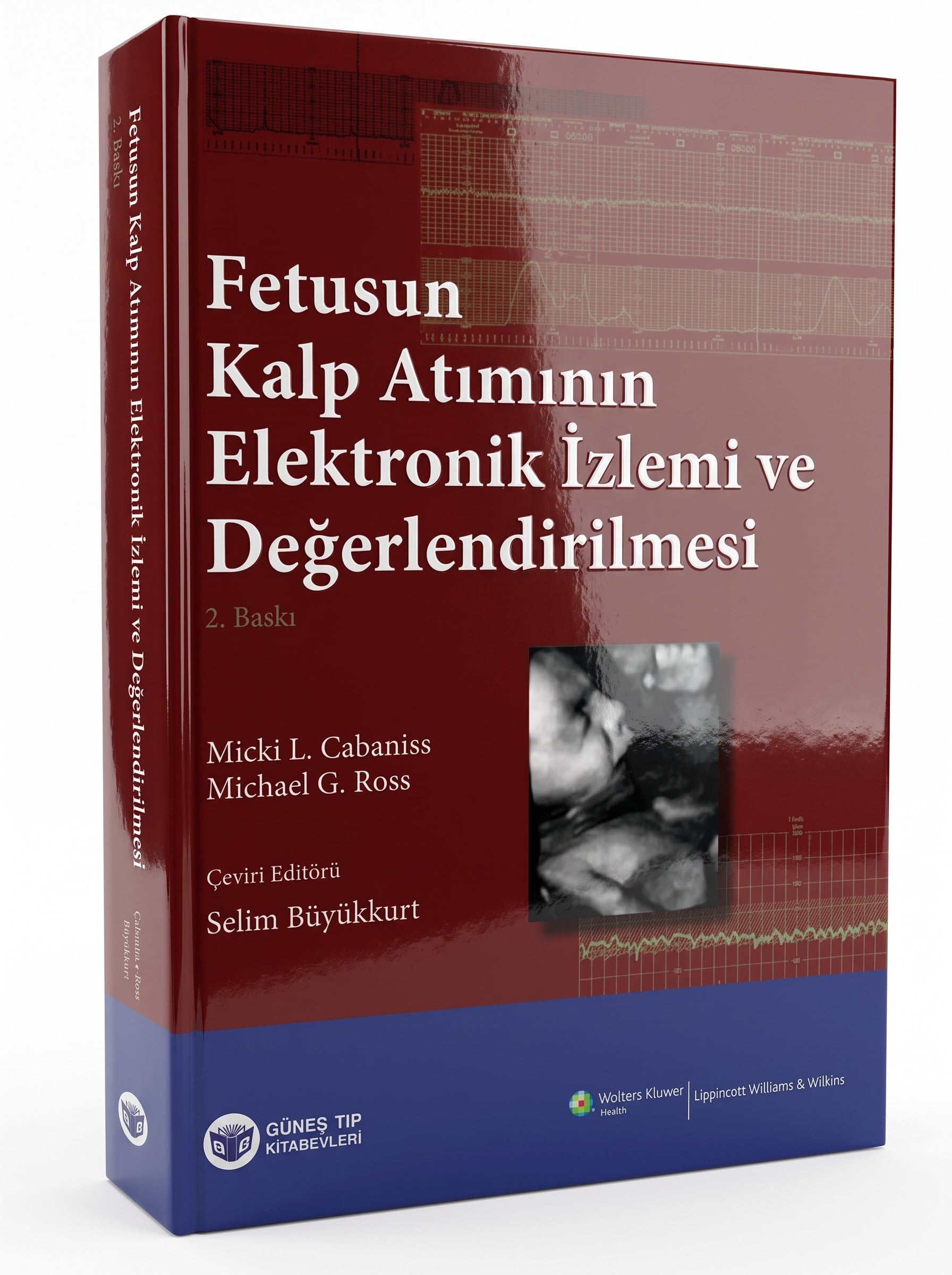 Fetusun Kalp Atımının Elektronik İzlemi ve Değerlendirilmesi