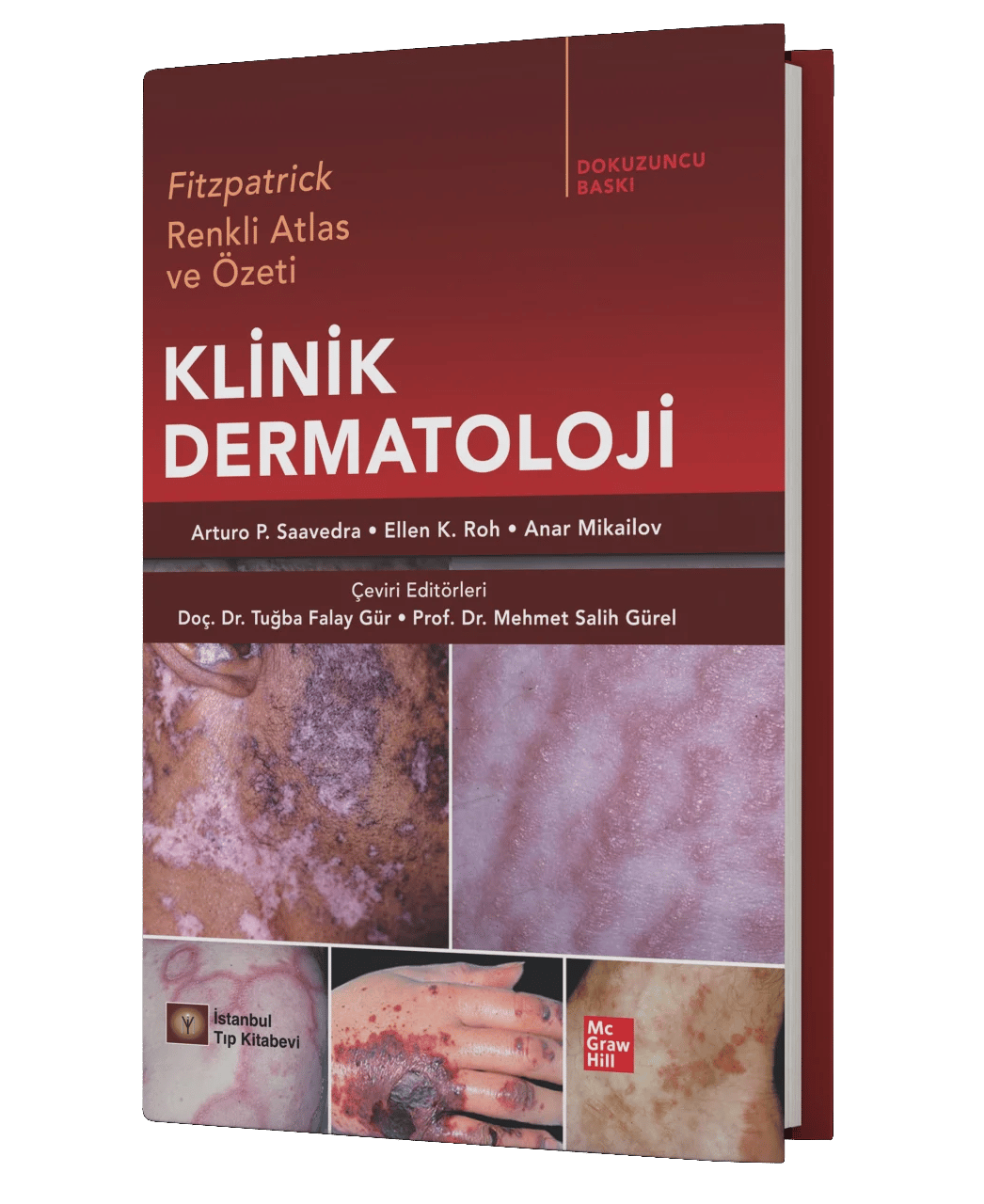 Fitzpatrick Renkli Atlas ve Özeti Klinik Dermatoloji