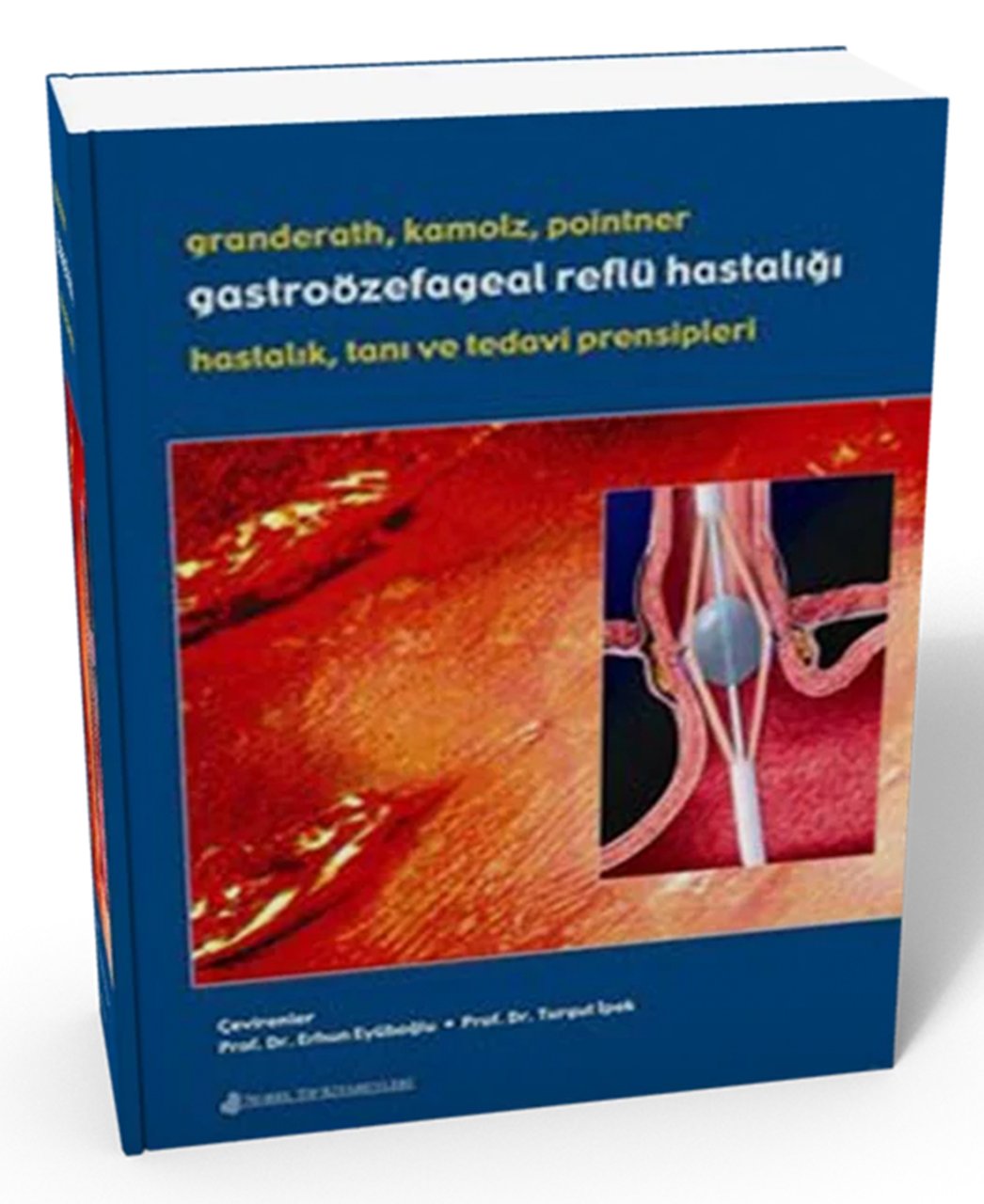 Gastroözefageal Reflü Hastalığı