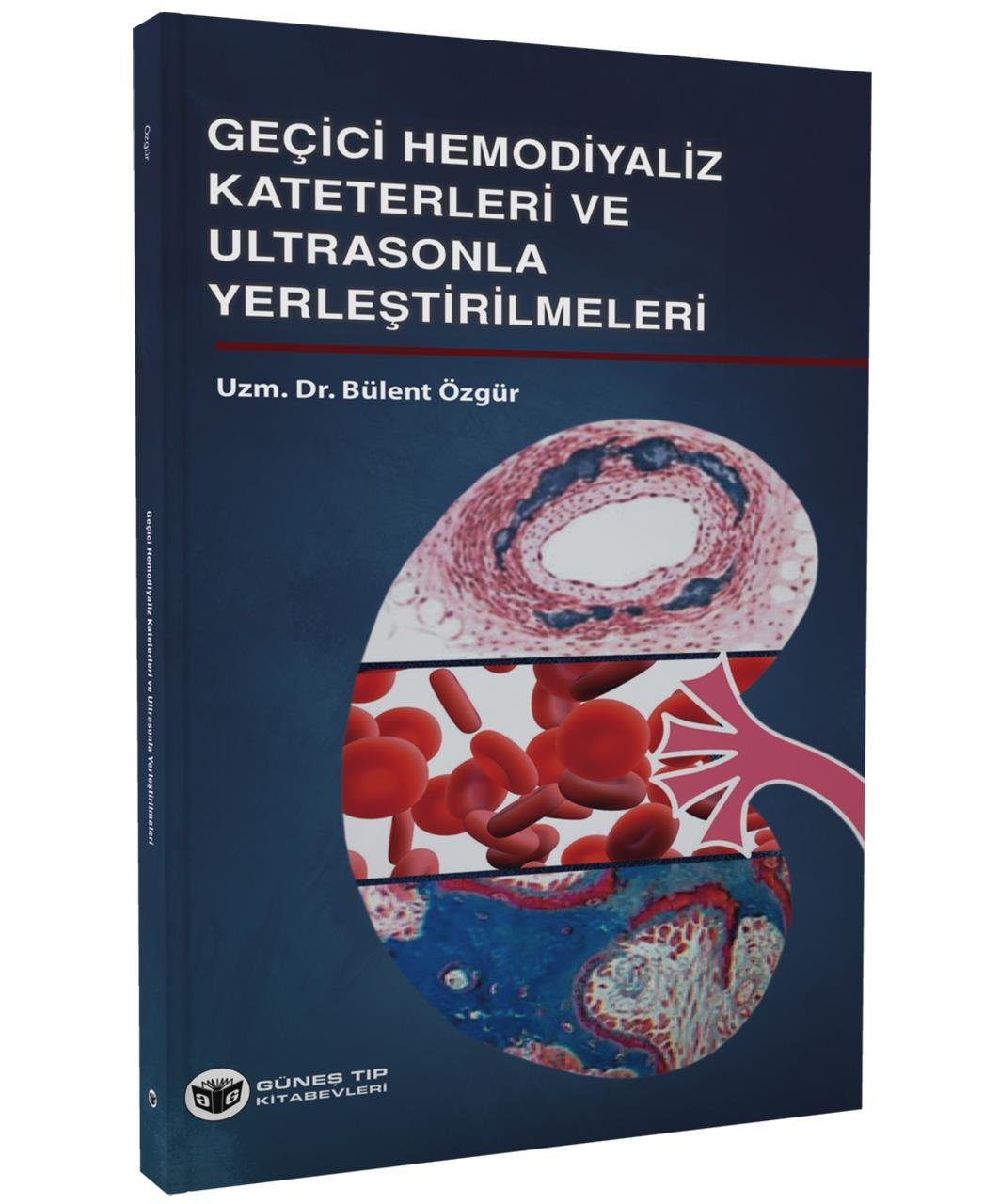 Geçici Hemodiyaliz Kateterleri ve Ultrasonla Yerleştirilmeleri