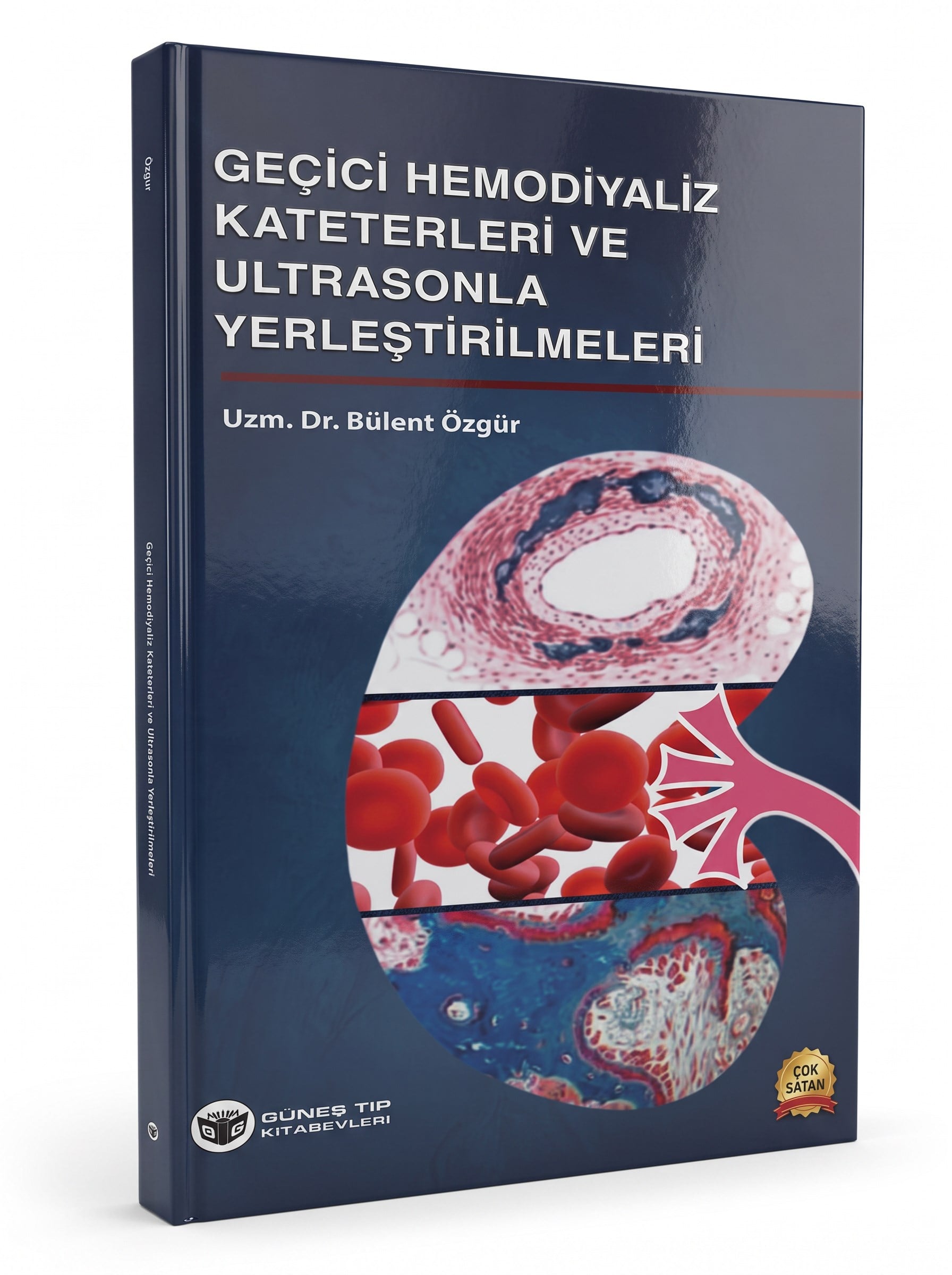 Geçici Hemodiyaliz Kateterleri ve Ultrasonla Yerleştirilmeleri
